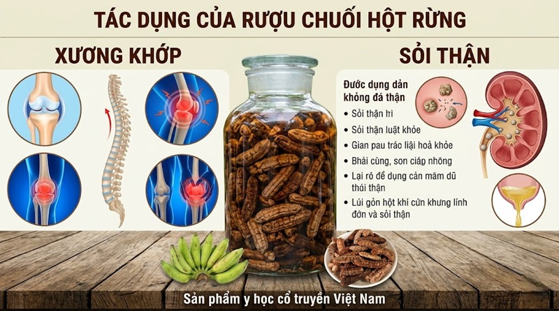 tác dụng của rượu chuối hột rừng đối với xương khớp và sỏi thận